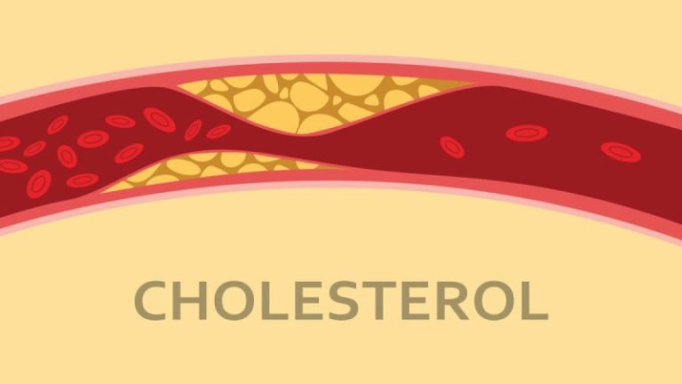 7 Φυσικές Θεραπείες για τη Μείωση Χοληστερίνης