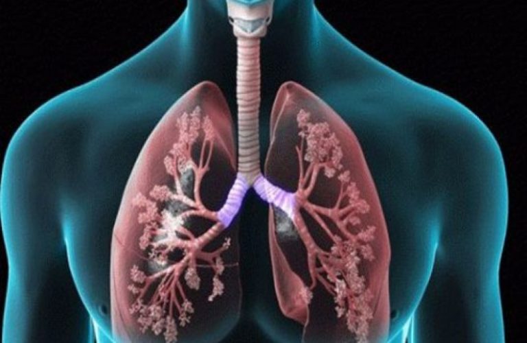 Η Επιδημία Των Πνευμόνων (ΧΑΠ): Tι αποκαλύπτουν οι έρευνες σχετικά με τη θεραπεία!
