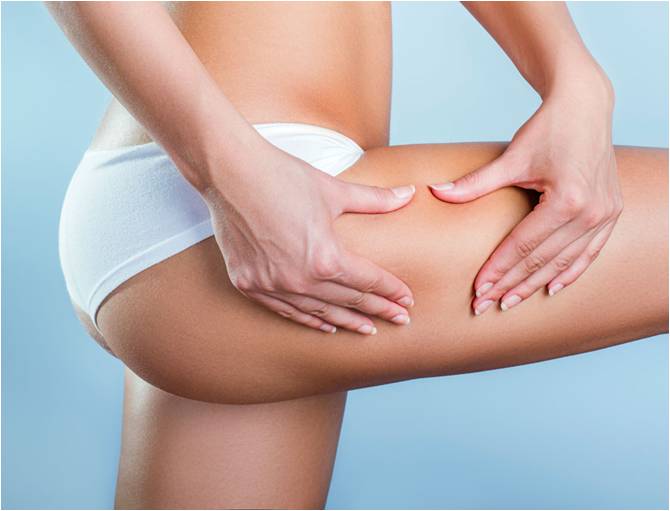 GET RID OF CELLULITE NATURALLY AND SAFELY!